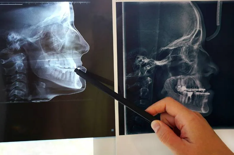 Cirurgião bucomaxilofacial em Itupeva