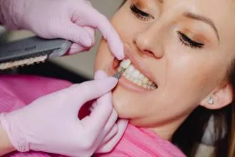 Facetas e lentes de contato dental em Itupeva
